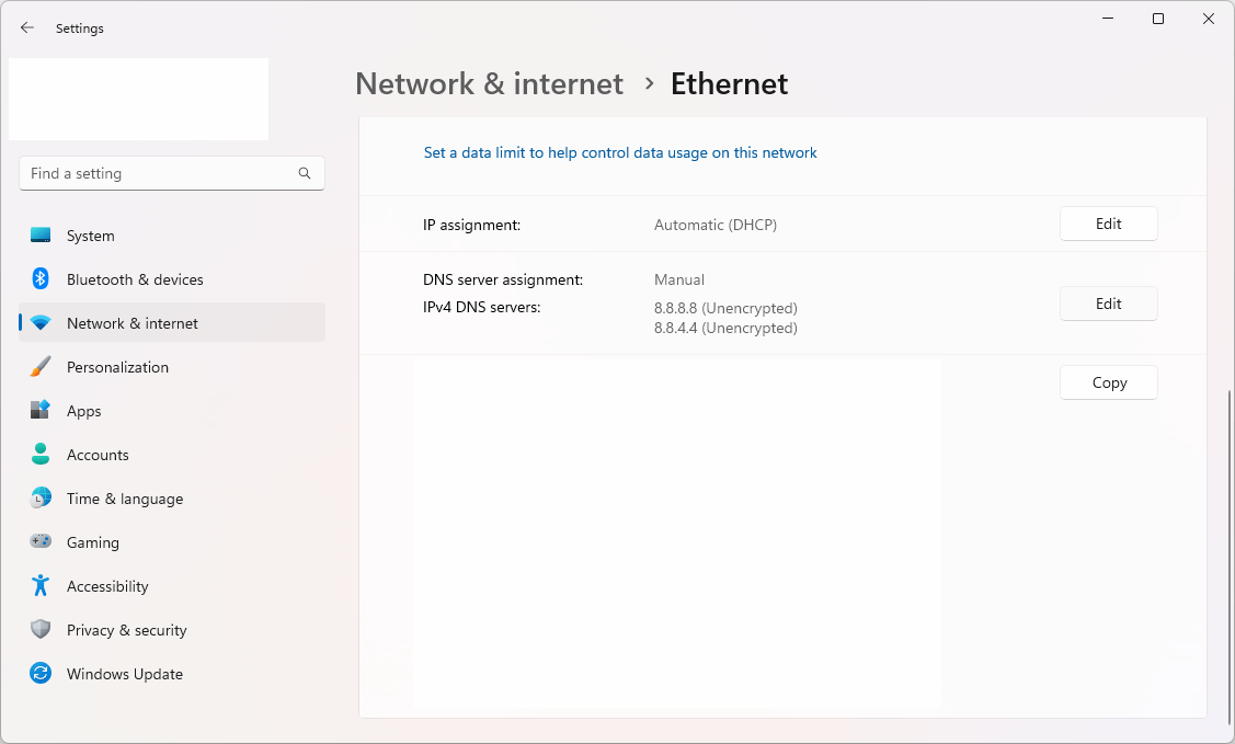 Top 5 best methods to fix error 0x80004005 on Windows today.